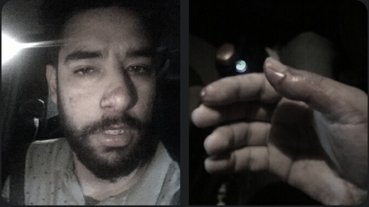 Journalist Aakash Hassan allegedly beaten by cops on NH way in Anantnag