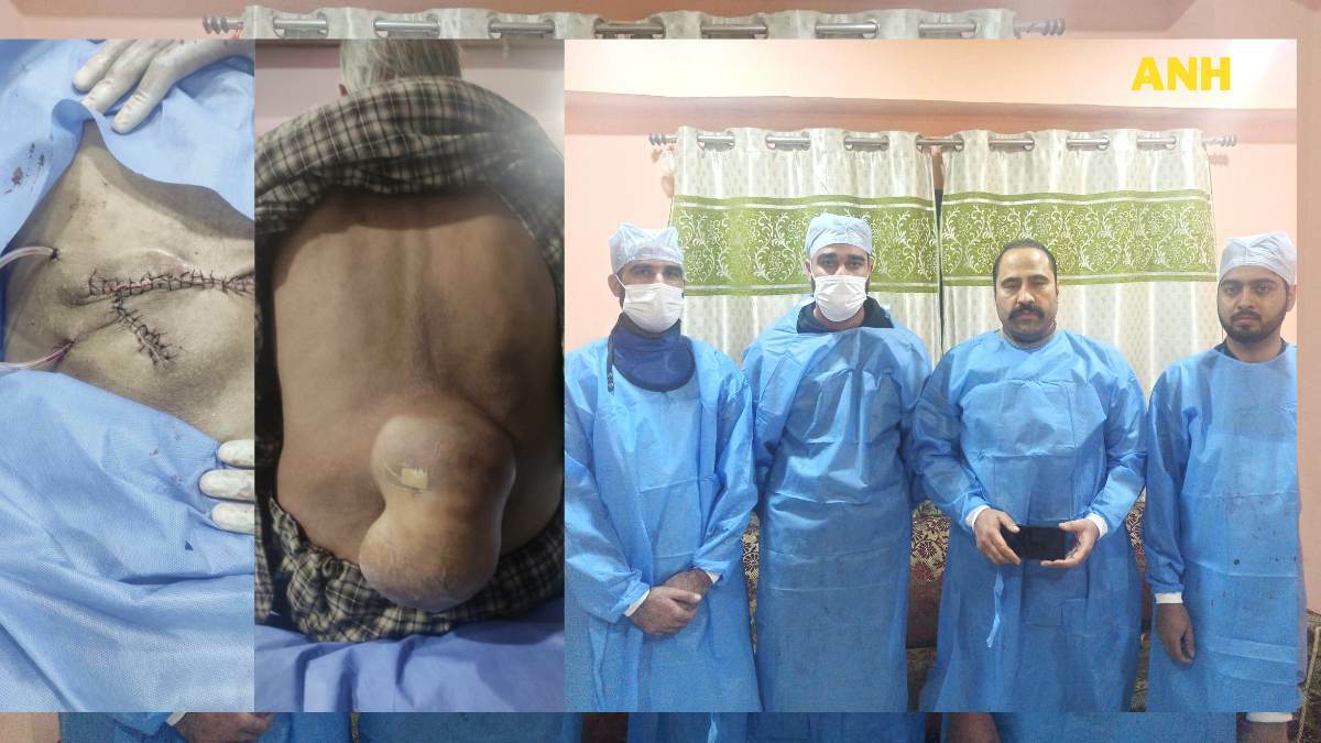 After 16 years, Anantnag man able to sleep properly, courtesy AB-PMJAY scheme After 16 years, Anantnag man able to sleep properly, courtesy AB-PMJAY scheme