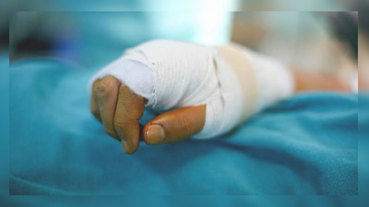 Woman suffers burn injuries in kerosene stove blast in Bandipora Woman suffers burn injuries in kerosene stove blast in Bandipora