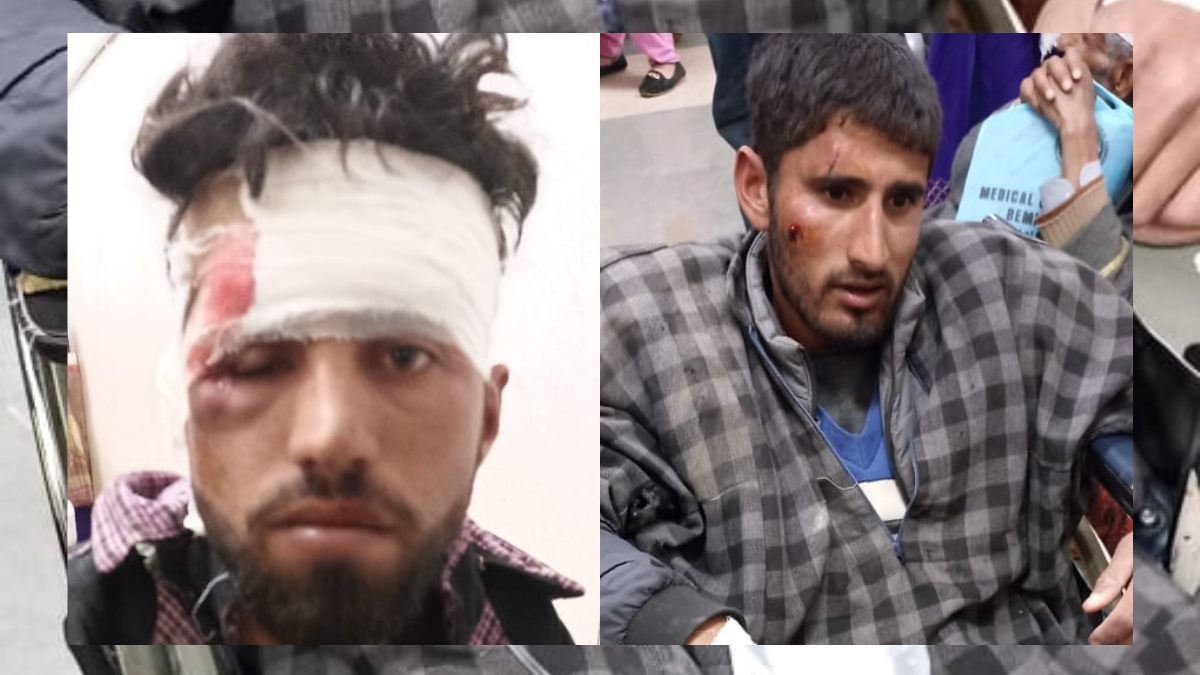 09 injured as vehicle turns turtle in Ganderbal 09 injured as vehicle turns turtle in Ganderbal