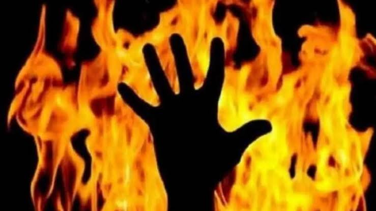 Teenage girl from Bemina succumbs to burn injuries at SMHS hospital Teenage girl from Bemina succumbs to burn injuries at SMHS hospital
